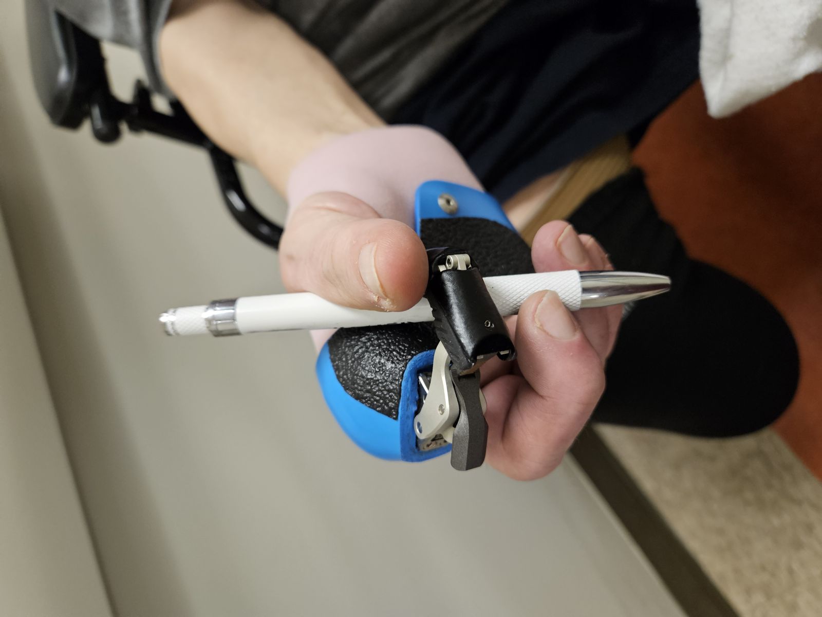 Prosthetics for Partial Hand Amputees: Restoring Function and Independence